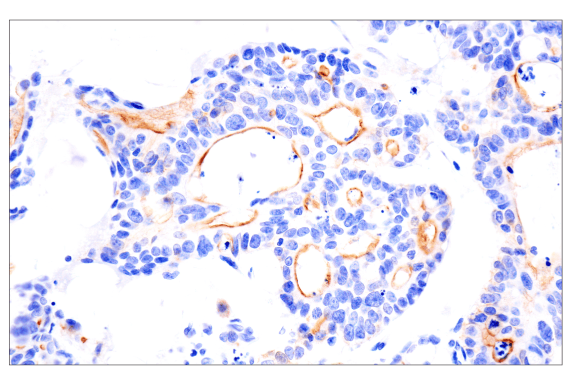 Immunohistochemistry Image 1: Angiomotin (F7W8U) Rabbit Monoclonal Antibody