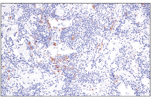 Immunohistochemistry Image 4: XCR1 (D2F8T) Rabbit Monoclonal Antibody