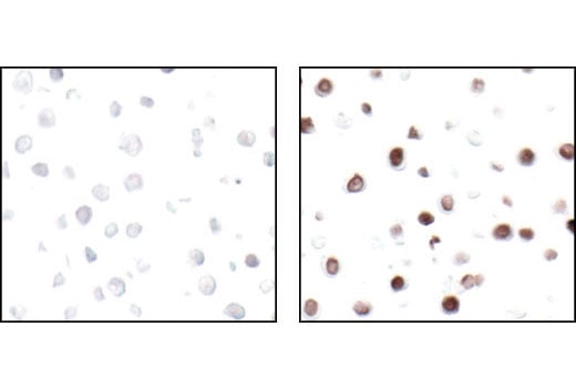 Immunohistochemistry Image 1: Phospho-Histone H2A.X (Ser139) (20E3) Rabbit Monoclonal Antibody (BSA and Azide Free)
