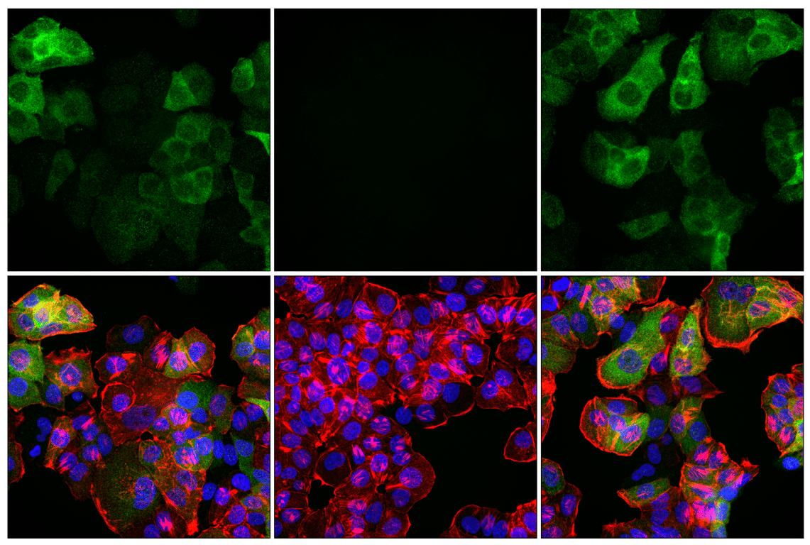 Immunofluorescence Image 2: Phospho-Tau (Ser202) (F2A2F) Rabbit Monoclonal Antibody
