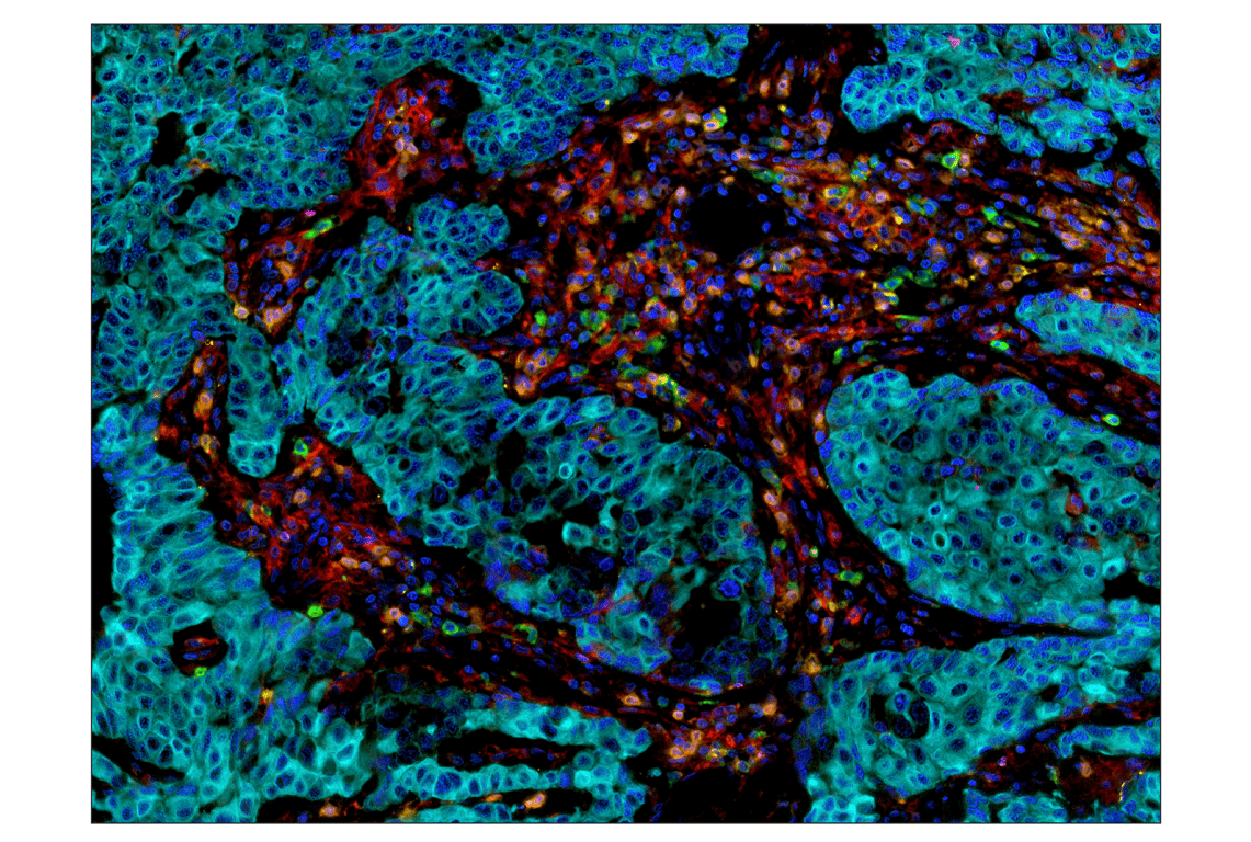 Immunohistochemistry Image 6: PD-L1 (E1L3N) Rabbit Monoclonal Antibody (BSA and Azide Free)