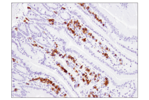 Immunohistochemistry Image 3: CD79B (D7V2F) Rabbit Monoclonal Antibody (BSA and Azide Free)