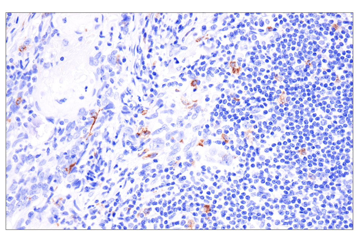 Immunohistochemistry Image 4: Langerin (F8L8I) Rabbit Monoclonal Antibody