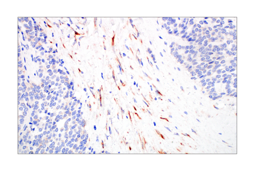 Immunohistochemistry Image 4: CYR61 (E5W3H) Rabbit Monoclonal Antibody