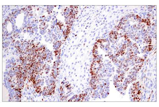 Immunohistochemistry Image 3: Cyclin D1 (E3P5S) Rabbit Monoclonal Antibody (BSA and Azide Free)