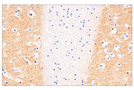 Immunohistochemistry Image 6: Glut3 (E7M7V) Rabbit Monoclonal Antibody