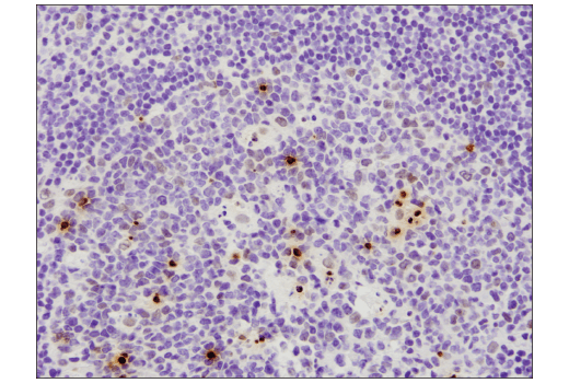 Immunohistochemistry Image 1: Phospho-Histone H2A.X (Ser139) (D7T2V) Mouse Monoclonal Antibody