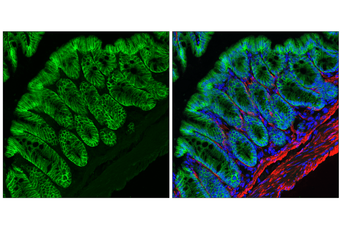 Immunofluorescence Image 2: Occludin (E6B4R) Rabbit Monoclonal Antibody