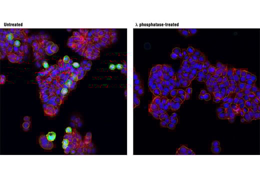Immunofluorescence Image 1: Phospho-cdc25C (Thr48) (D2H3) Rabbit Monoclonal Antibody