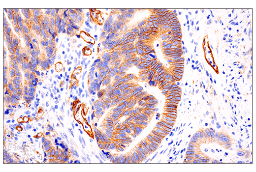 Immunohistochemistry Image 1: Insulin Receptor β (E9L5V) XP<sup>®</sup> Rabbit mAb (BSA and Azide Free)