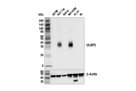 Western Blotting Image 2: ULBP2 (E6S7D) Rabbit Monoclonal Antibody