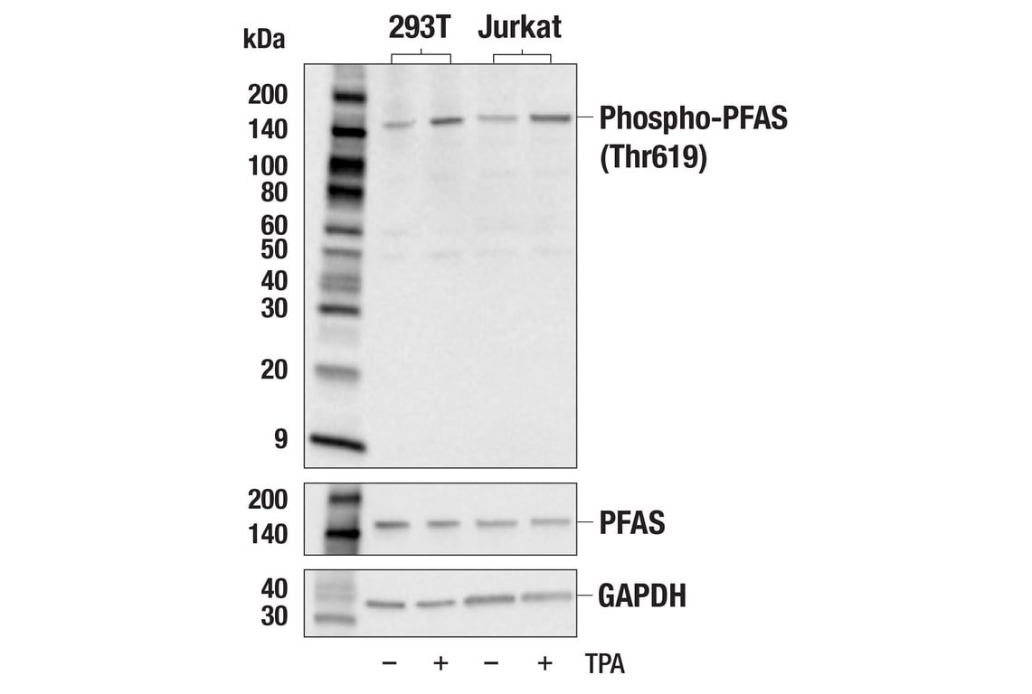 Western Blotting Image 2: Phospho-PFAS (Thr619) Antibody