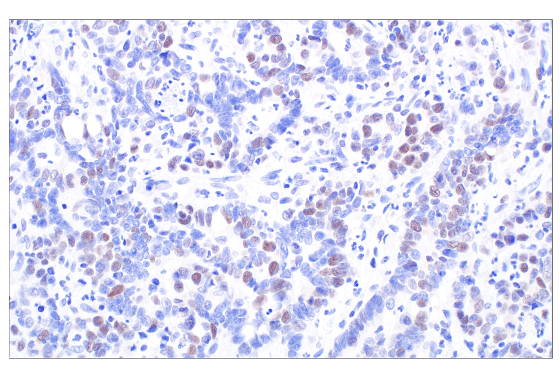 Immunohistochemistry Image 4: MASTL (F7I2C) Rabbit Monoclonal Antibody
