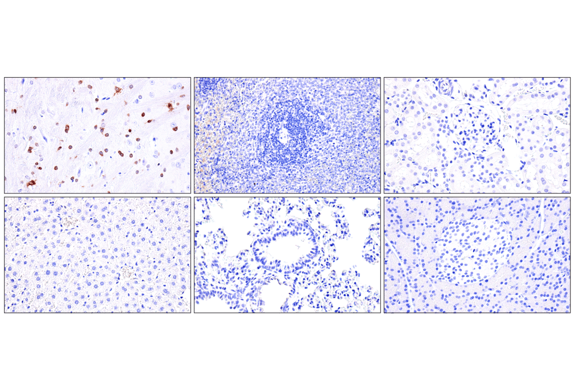 Immunohistochemistry Image 5: Olig1 (E3T6D) Rabbit Monoclonal Antibody