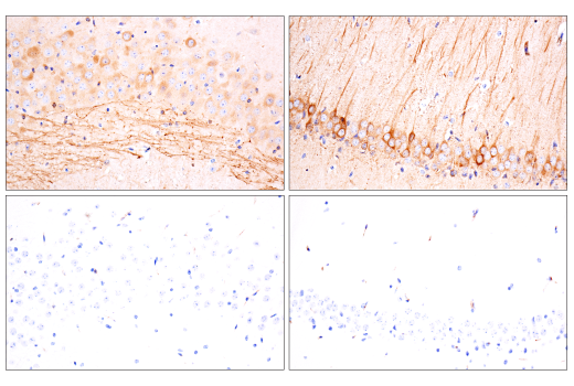 Immunohistochemistry Image 2: Phospho-Tau (Thr205) (E3E3B) Mouse Monoclonal Antibody