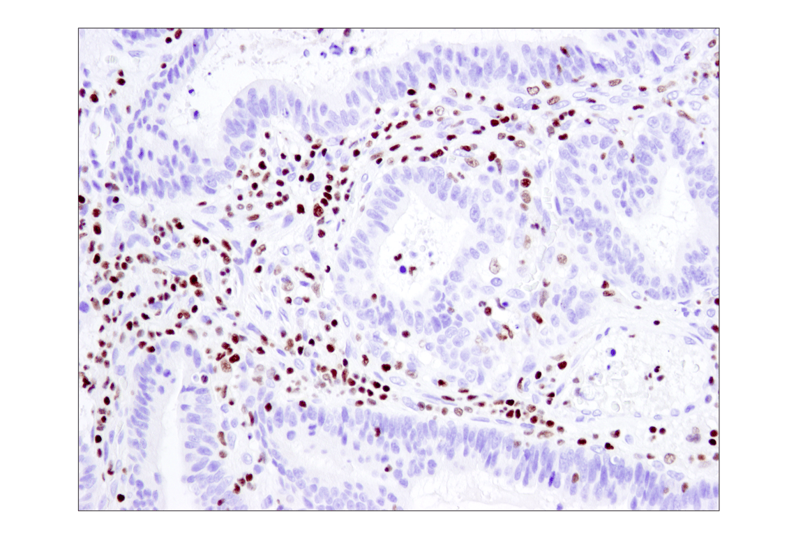Immunohistochemistry Image 1: Ikaros (D6N9Y) Rabbit Monoclonal Antibody