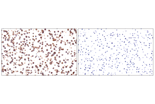 Immunohistochemistry Image 7: CD20 (E7B7T) Rabbit Monoclonal Antibody (BSA and Azide Free)