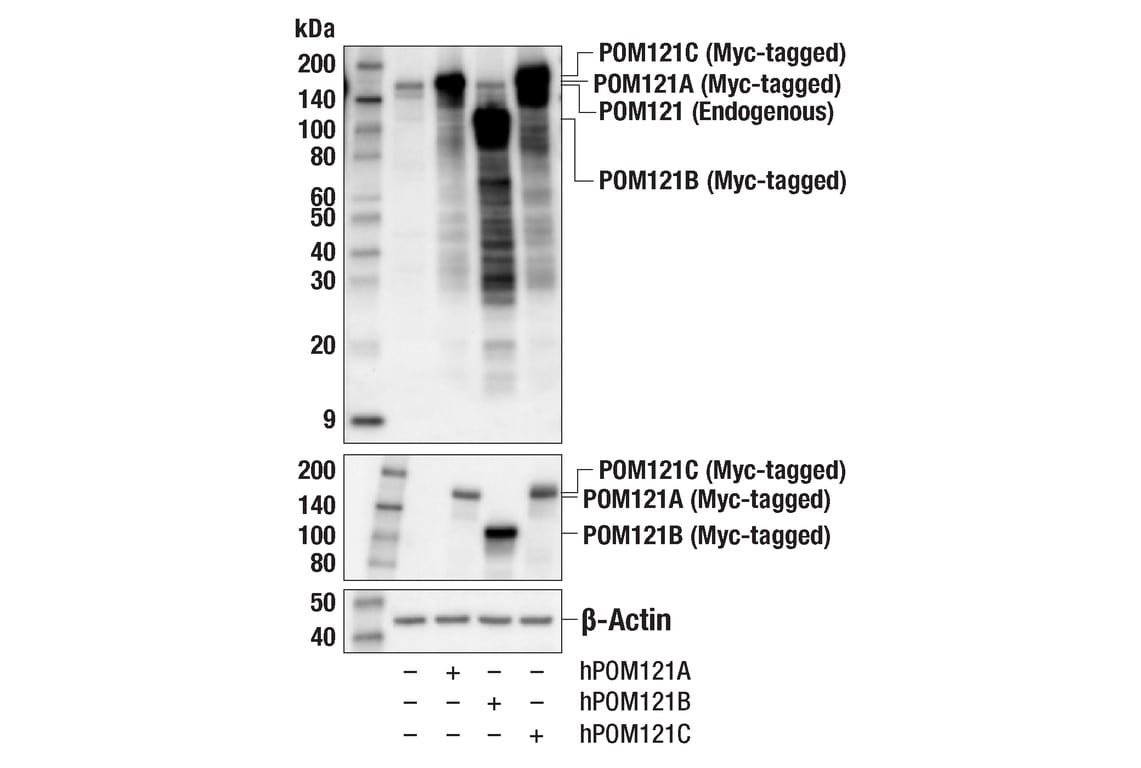 Western Blotting Image 3: POM121 (E3W3J) Rabbit Monoclonal Antibody