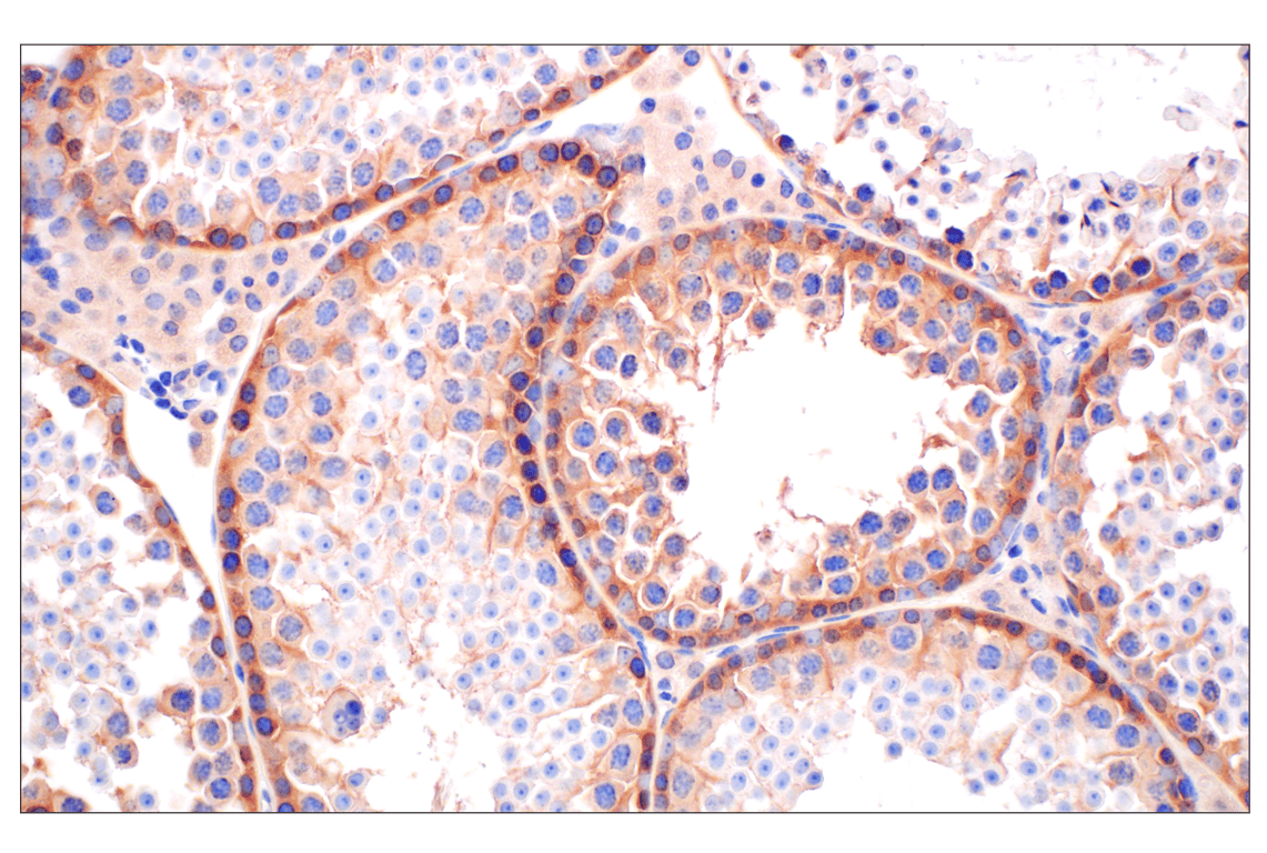 Immunohistochemistry Image 9: PIP4K2C (E7P3S) Rabbit Monoclonal Antibody (BSA and Azide Free)