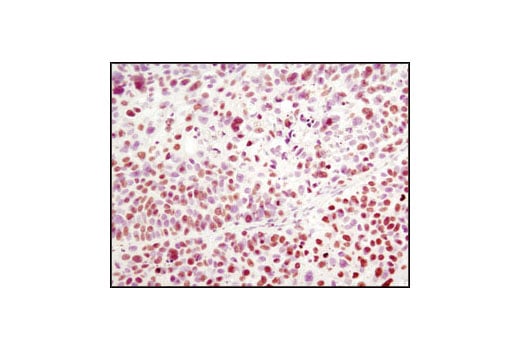 Immunohistochemistry Image 1: Histone H2A (L88A6) Mouse Monoclonal Antibody (BSA and Azide Free)