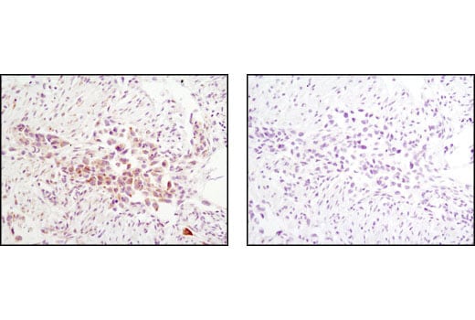 undefined Image 11: Jak Isoform Antibody Sampler Kit