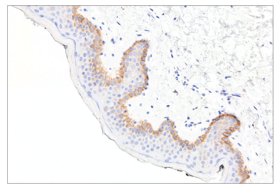 Immunohistochemistry Image 4: FGF Receptor 2IIIb (FPR2-D) Mouse Monoclonal Antibody