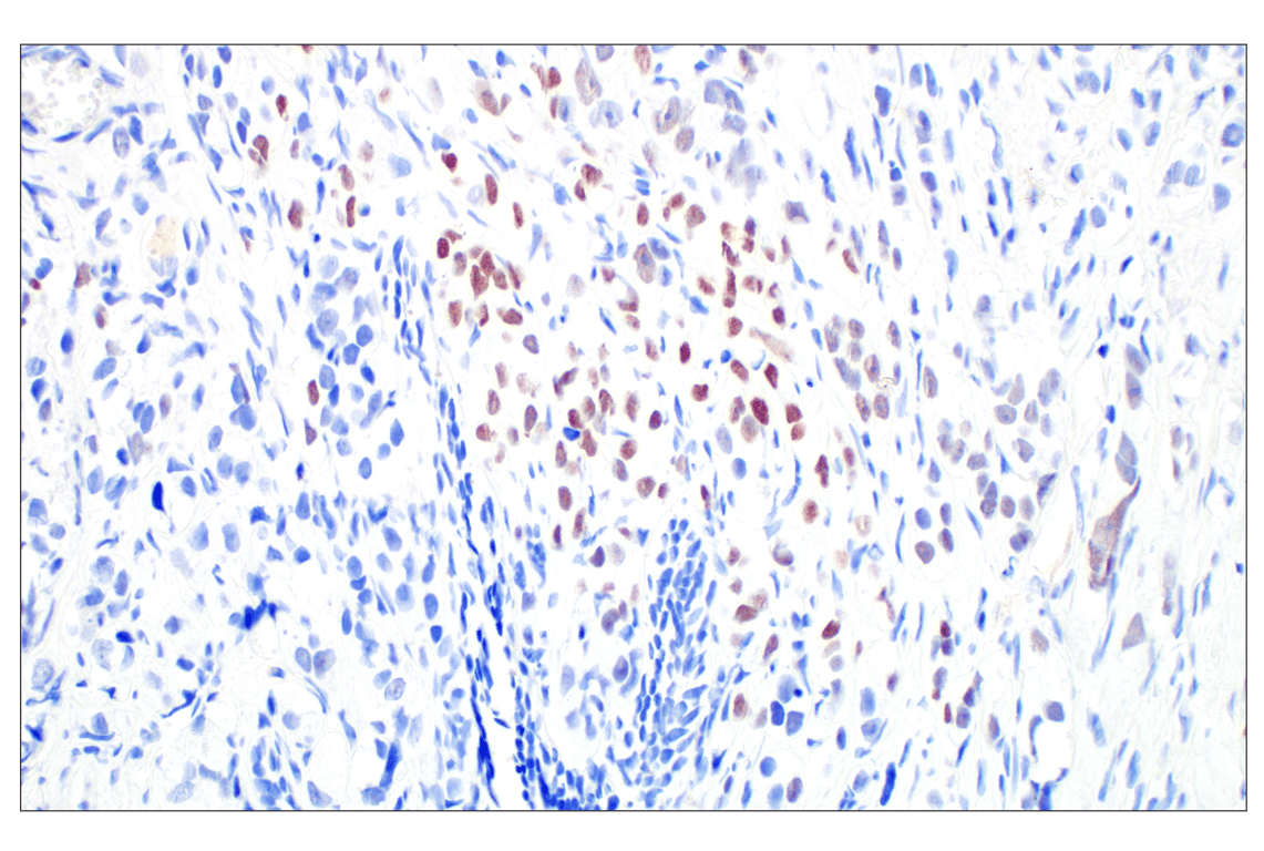 undefined Image 28: DNA Damage Antibody Sampler Kit