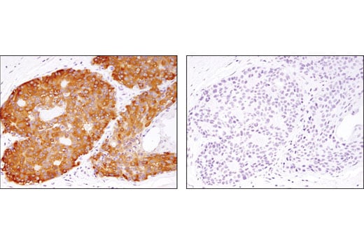 Immunohistochemistry Image 1: Phospho-PRAS40 (Thr246) (D4D2) Rabbit Monoclonal Antibody