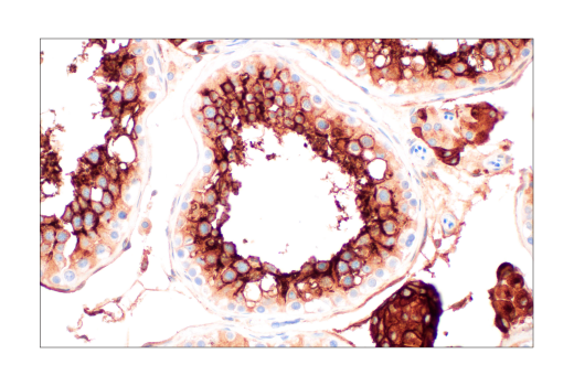 Immunohistochemistry Image 3: ACE2 (OTI1G4) Mouse Monoclonal Antibody