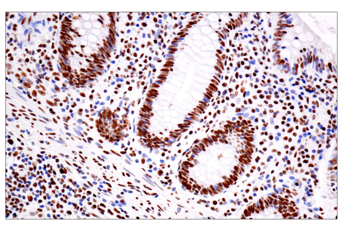 Immunohistochemistry Image 6: ILF3 (E5H6F) Rabbit Monoclonal Antibody