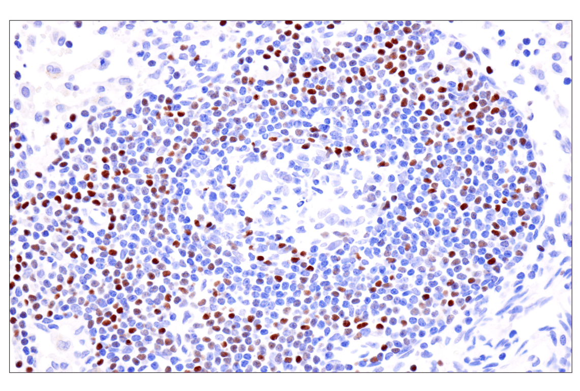 Immunohistochemistry Image 4: TCF1/TCF7 (E6O1K) Rabbit Monoclonal Antibody