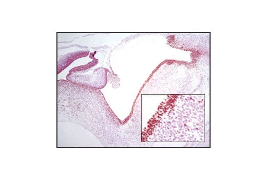 Immunohistochemistry Image 2: Sox2 (C70B1) Rabbit Monoclonal Antibody