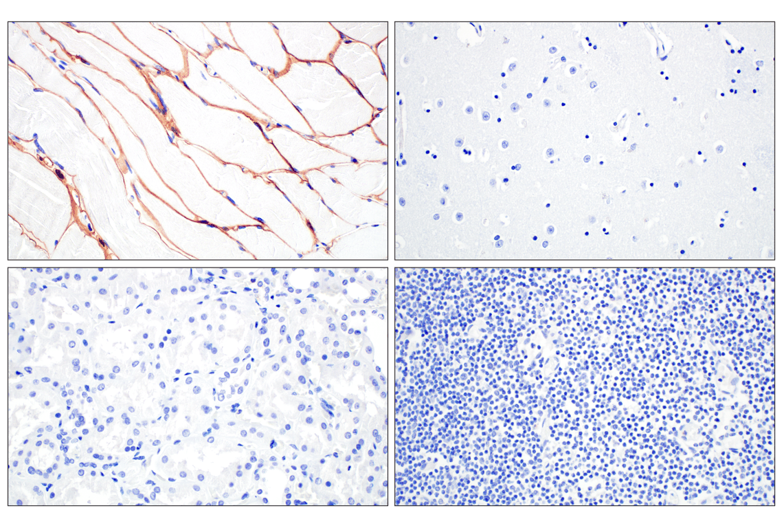 Immunohistochemistry Image 6: Dystrophin (E4F3S) Rabbit Monoclonal Antibody