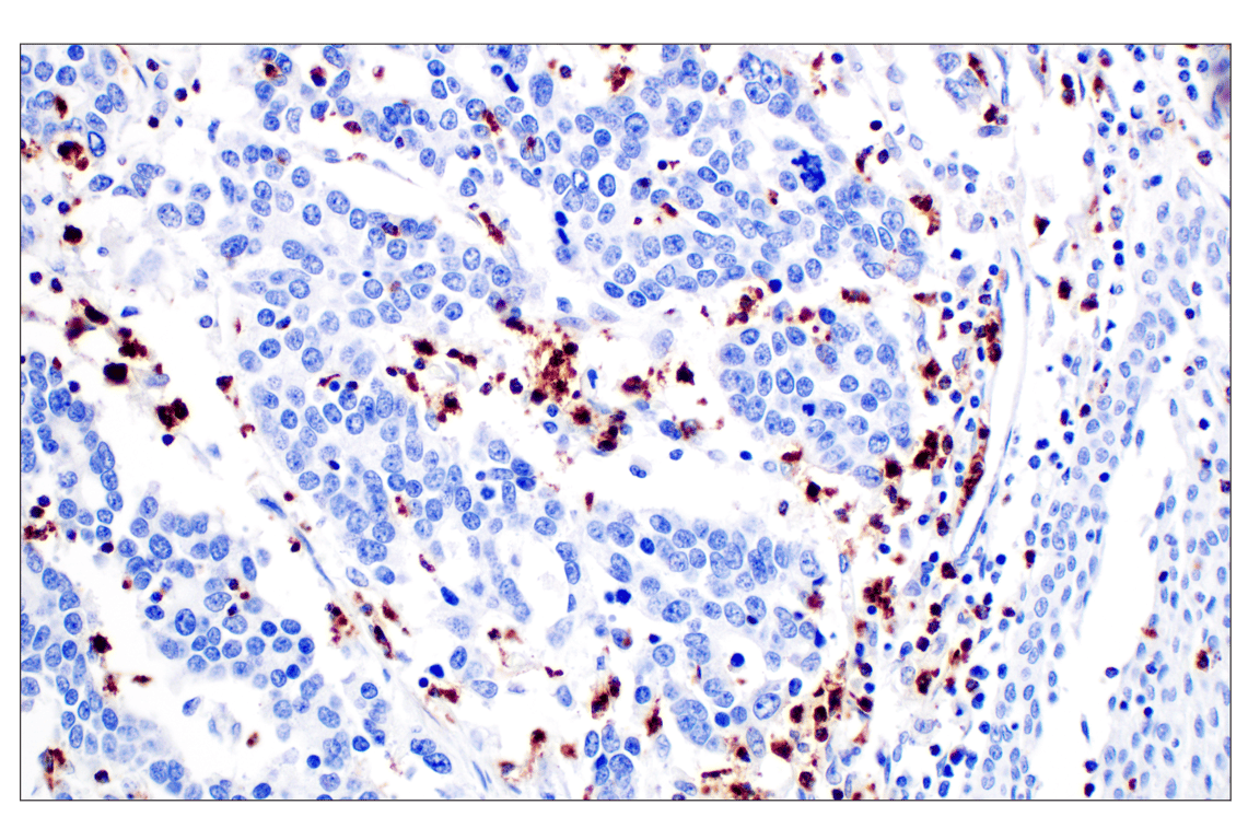 Immunohistochemistry Image 4: NKG7 (F4V5I) Rabbit Monoclonal Antibody