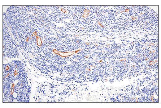 Immunohistochemistry Image 4: IGFBP7 (E3Z8L) Rabbit Monoclonal Antibody