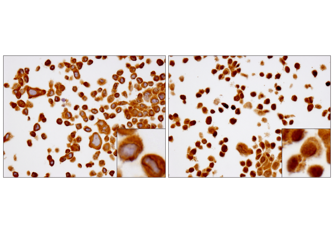 Immunohistochemistry Image 1: NF-kappaB p65 (D14E12) Rabbit Monoclonal Antibody