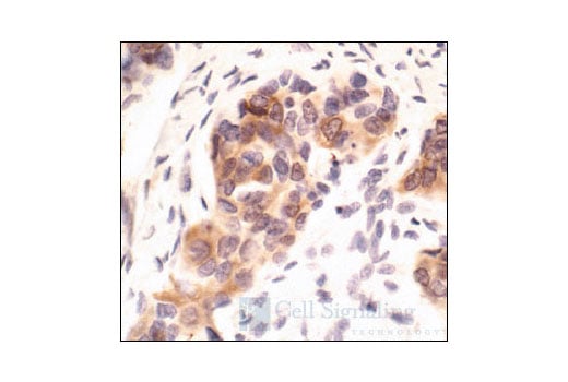 undefined Image 17: Phospho-PKC Antibody Sampler Kit