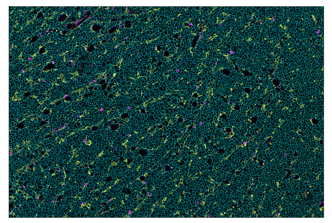 Immunohistochemistry Image 1: CD20 (E3N7O) & CO-0134-594 SignalStar<sup>™</sup> Oligo-Antibody Pair