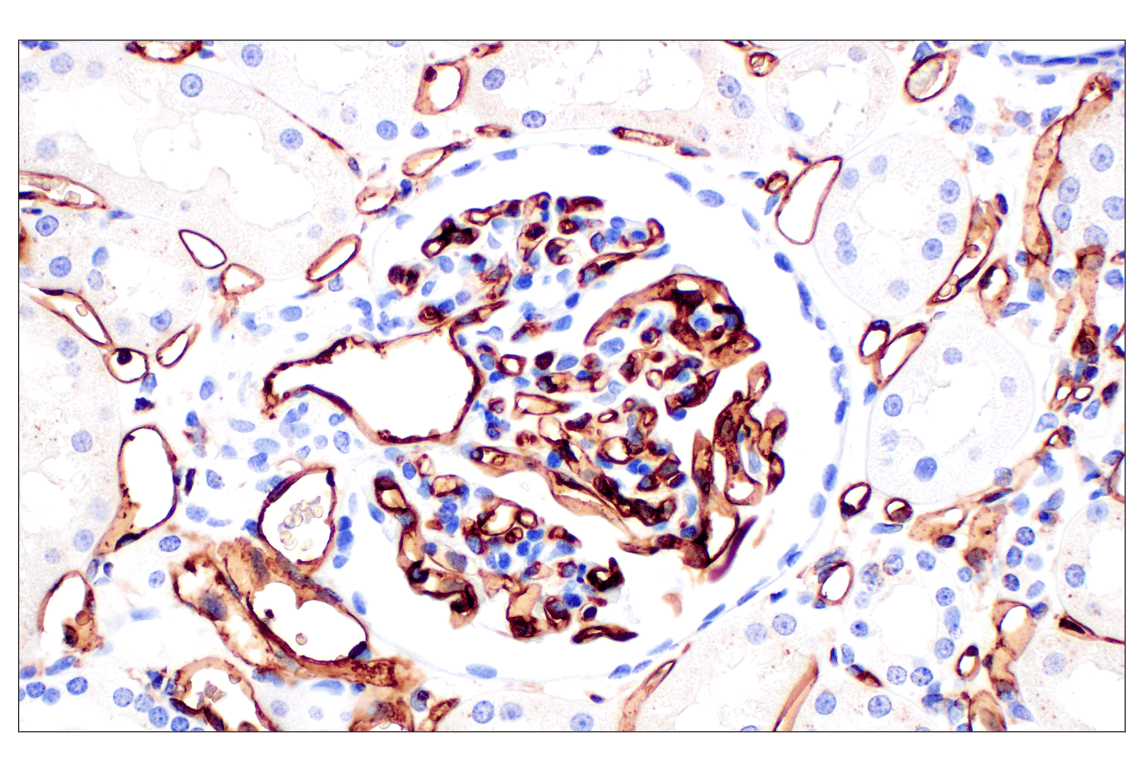 Immunohistochemistry Image 4: CD31 (PECAM-1) (F8M3S) Rabbit Monoclonal Antibody (BSA and Azide Free)