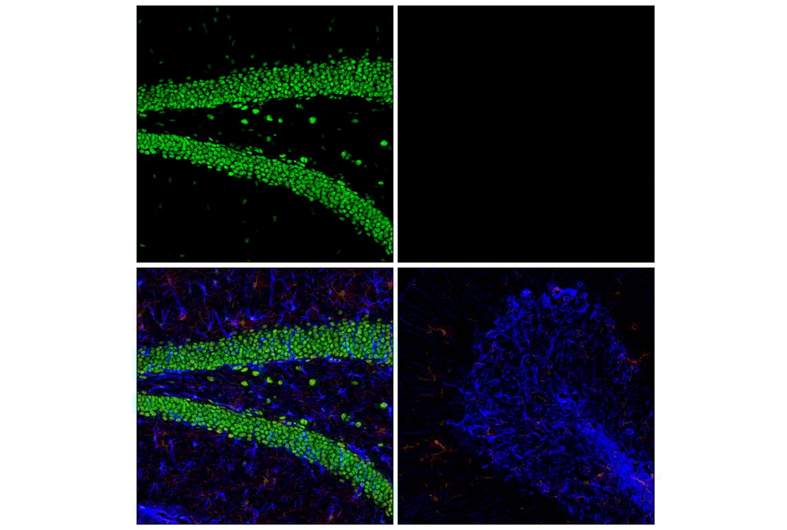 Immunofluorescence Image 1: FOXG1 (E2W8P) Rabbit Monoclonal Antibody