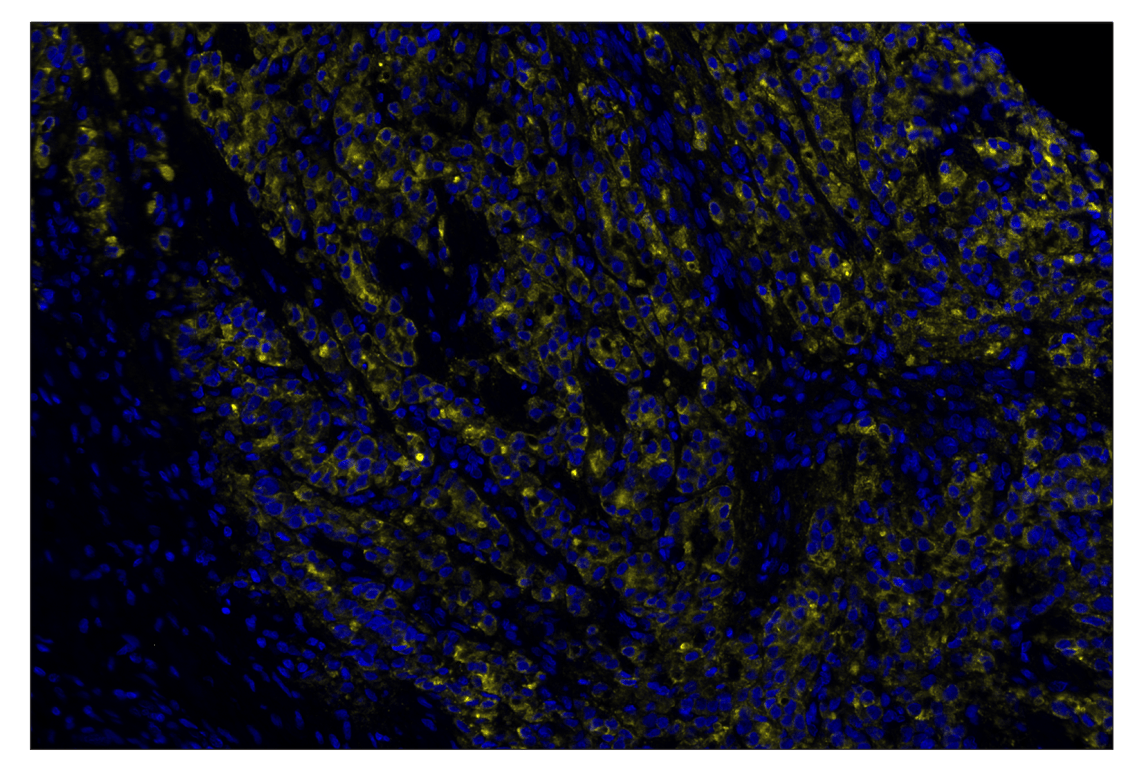 Immunohistochemistry Image 2: Prostate Specific Membrane Antigen (D7I8E) & CO-0152-488 SignalStar<sup>™</sup> Oligo-Antibody Pair