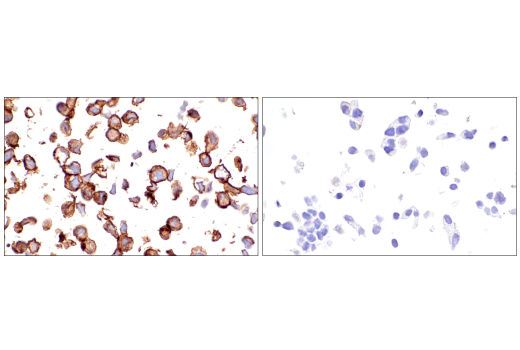 undefined Image 42: SARS-CoV-2 Virus-Host Interaction Antibody Sampler Kit