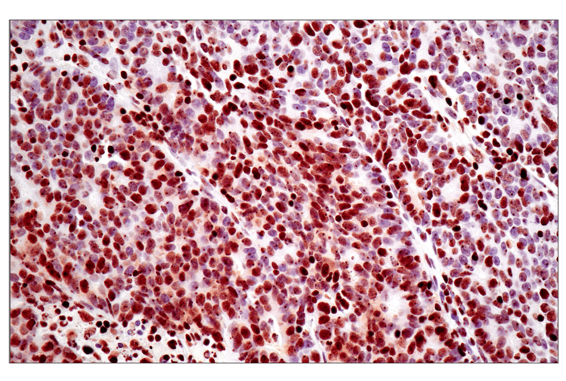 Immunohistochemistry Image 2: Tri-Methyl-Histone H3 (Lys27) (C36B11) Rabbit mAb