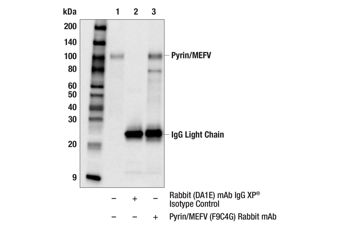 Immunoprecipitation Image 1: Pyrin/MEFV (F9C4G) Rabbit Monoclonal Antibody