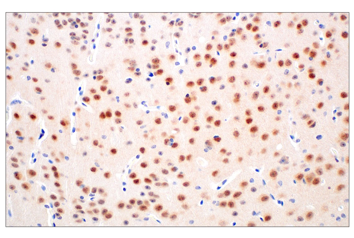 Immunohistochemistry Image 11: ARK5 (E4T2A) Rabbit Monoclonal Antibody