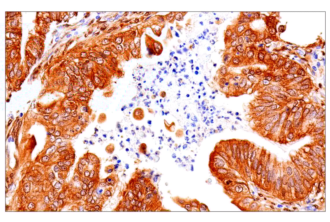 Immunohistochemistry Image 4: Phospho-YAP (Ser61) (E4Q8S) Rabbit Monoclonal Antibody