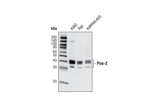 Western Blotting Image 1: Pim-2 (D1D2) Rabbit mAb