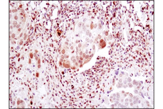 Immunohistochemistry Image 1: Phospho-Stat1 (Ser727) (D3B7) Rabbit Monoclonal Antibody (BSA and Azide Free)