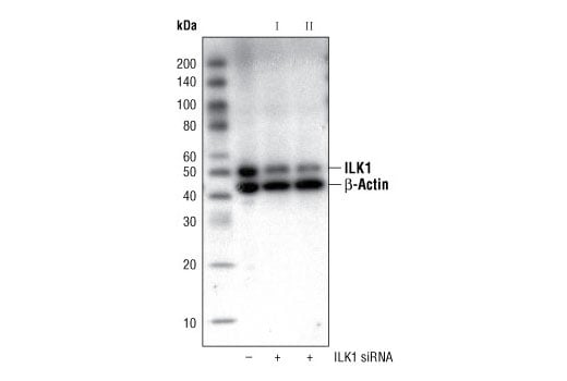 Western Blotting Image 2: ILK1 (4G9) Rabbit Monoclonal Antibody