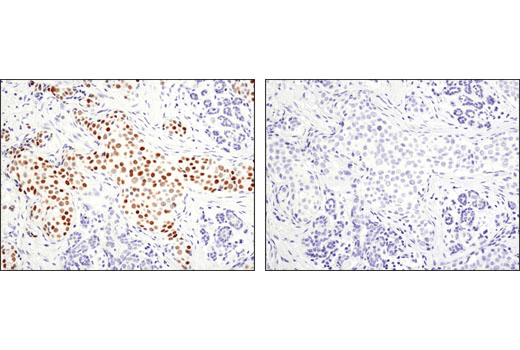 Immunohistochemistry Image 1: GATA-3 (D13C9) Rabbit Monoclonal Antibody (BSA and Azide Free)